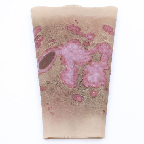 TraumaSim Wearable Large Burn Forearm